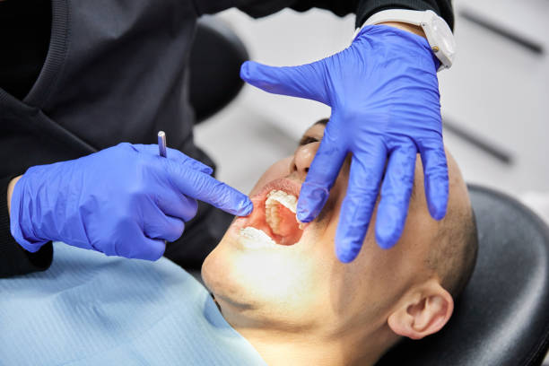 Best Emergency Tooth Extraction in Washington Terrace, UT